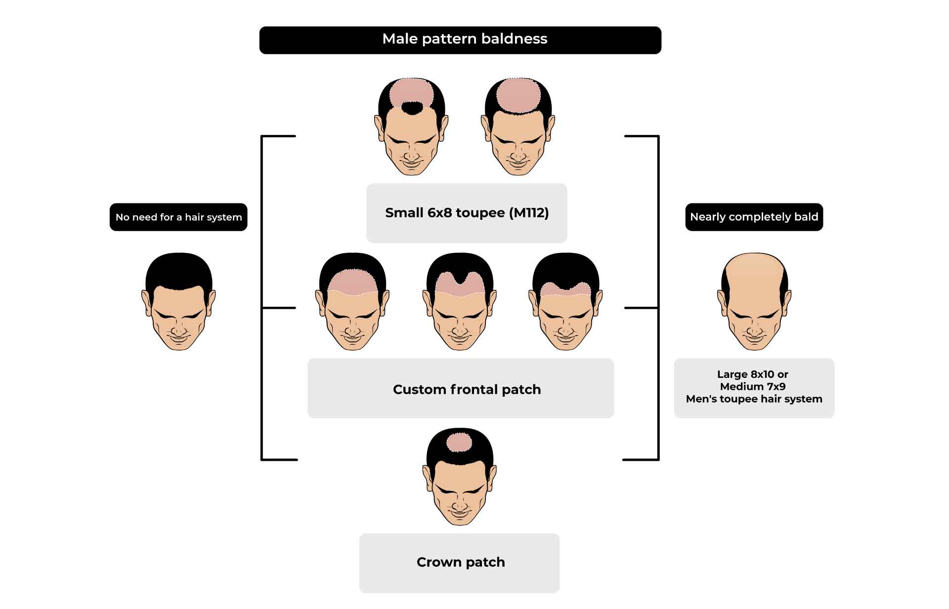 hair loss