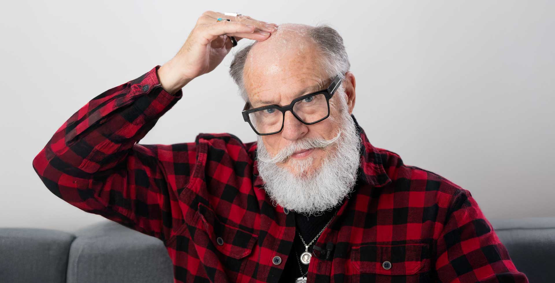 A visual representation of how to attach the toupee on the scalp